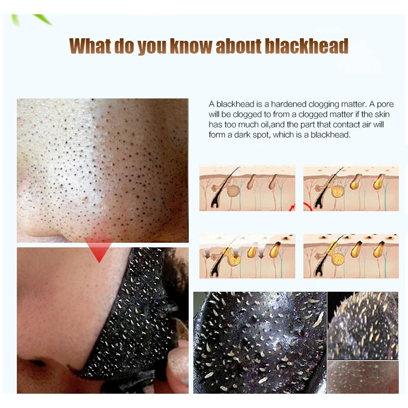 EFERO Black Head Remover Mask Black Face Mask Acne Treatments