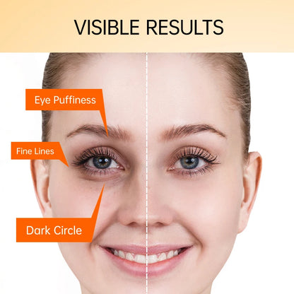 Vitamin C Eye Bags Anti Dark Circles Cream Wrinkle Remove