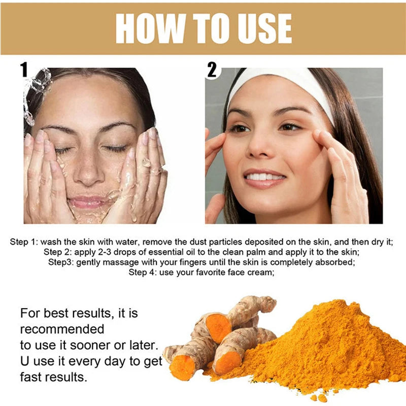 Turmeric Freckle Whitening Serum Fade Dark Spot Removal Pigment