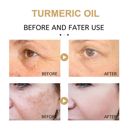 Turmeric Freckle Whitening Serum Fade Dark Spot Removal Pigment