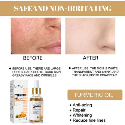 Turmeric Freckle Whitening Serum Fade Dark Spot Removal Pigment