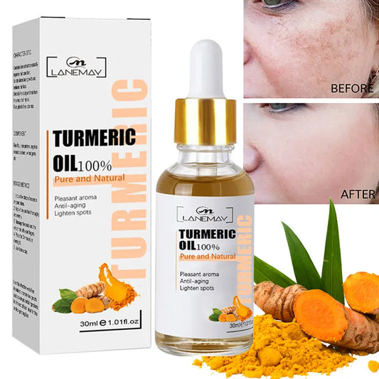 Turmeric Freckle Whitening Serum Fade Dark Spot Removal Pigment